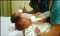 Babies were given formula milk in the study